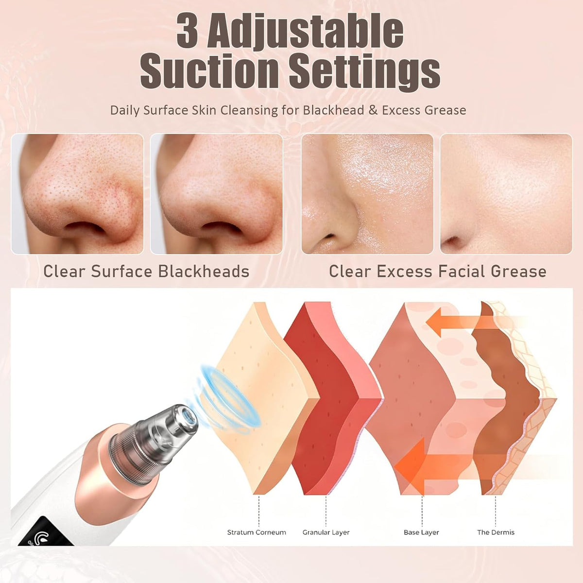 2026 Blackhead Remover Pore Vacuum,Facial Pore Cleaner-5 Suction Power,5 Probes,USB Rechargeable Blackhead Vacuum Kit Electric Pore Vacuum Tool for Adult